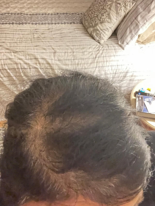 Before - Shyla George